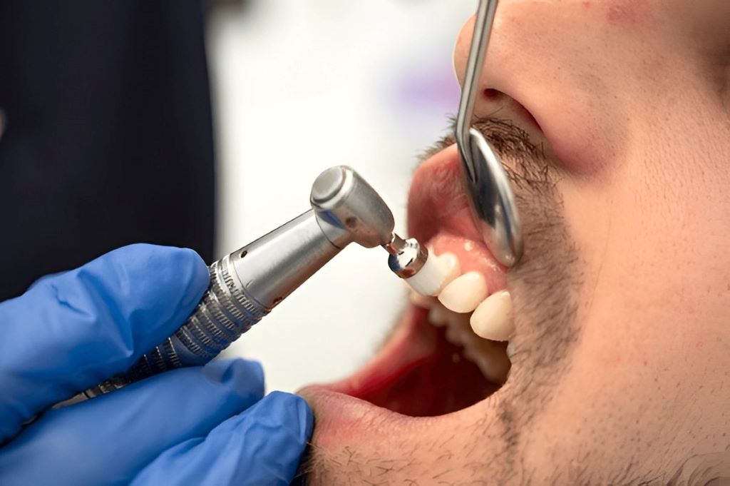 dental cleanings near you
