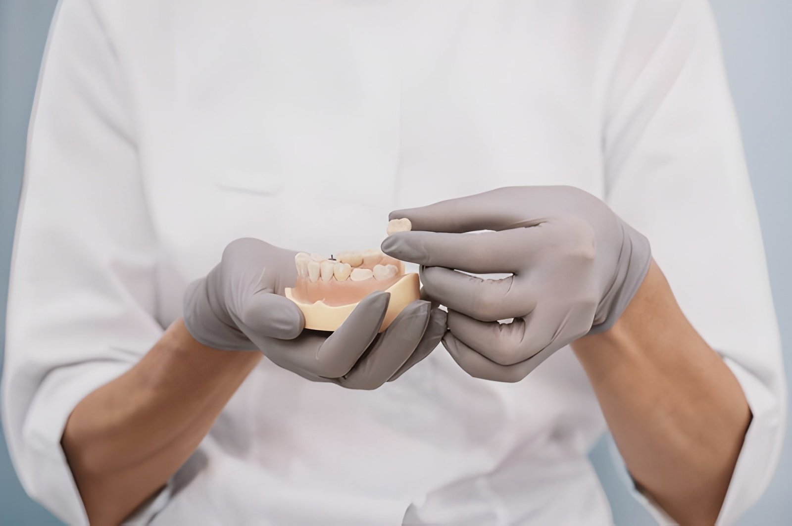 dental crowns in burlington on