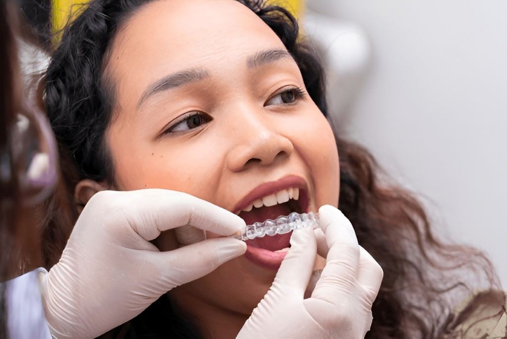 invisalign in burlington on
