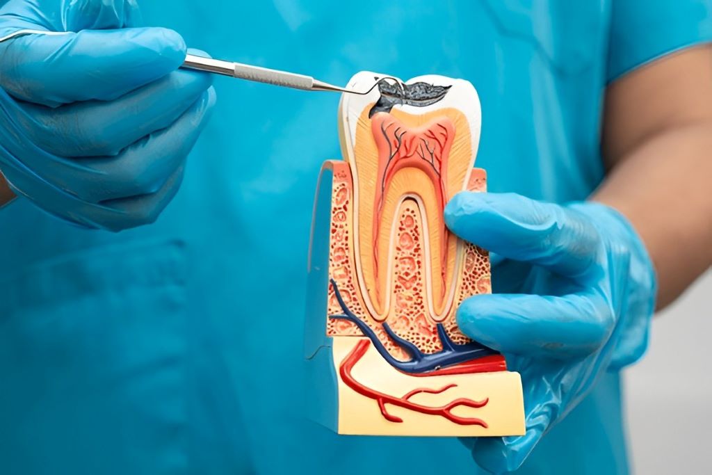 root canal therapy near you