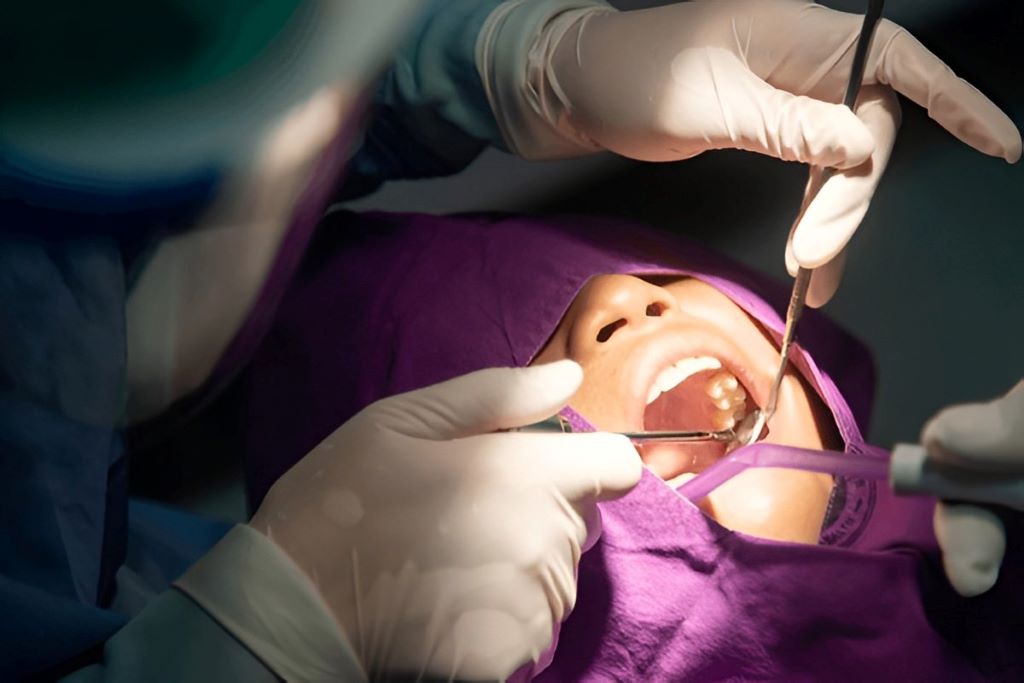 wisdom teeth removal in burlington on