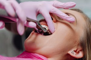 Dental emergency here s what you should do immediately