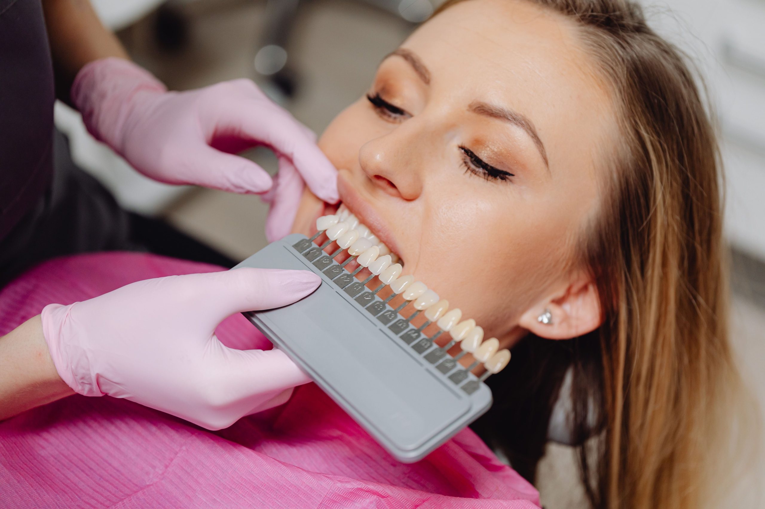 Cosmetic dentistry smile transformation with natural-looking teeth